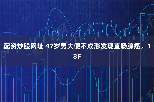 配资炒股网址 47岁男大便不成形发现直肠腺癌，18F